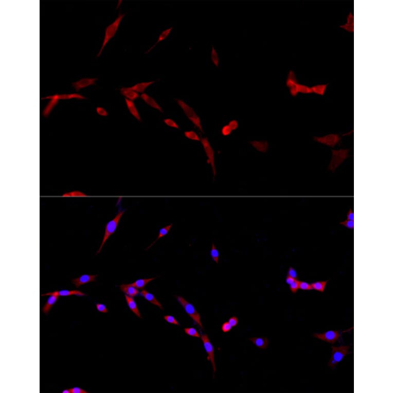 Immunofluorescence - Anti-TNFSF5 Antibody (A89100) - Antibodies.com