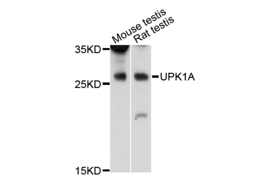 Western Blot - Anti-UPK1A Antibody (A12761) - Antibodies.com