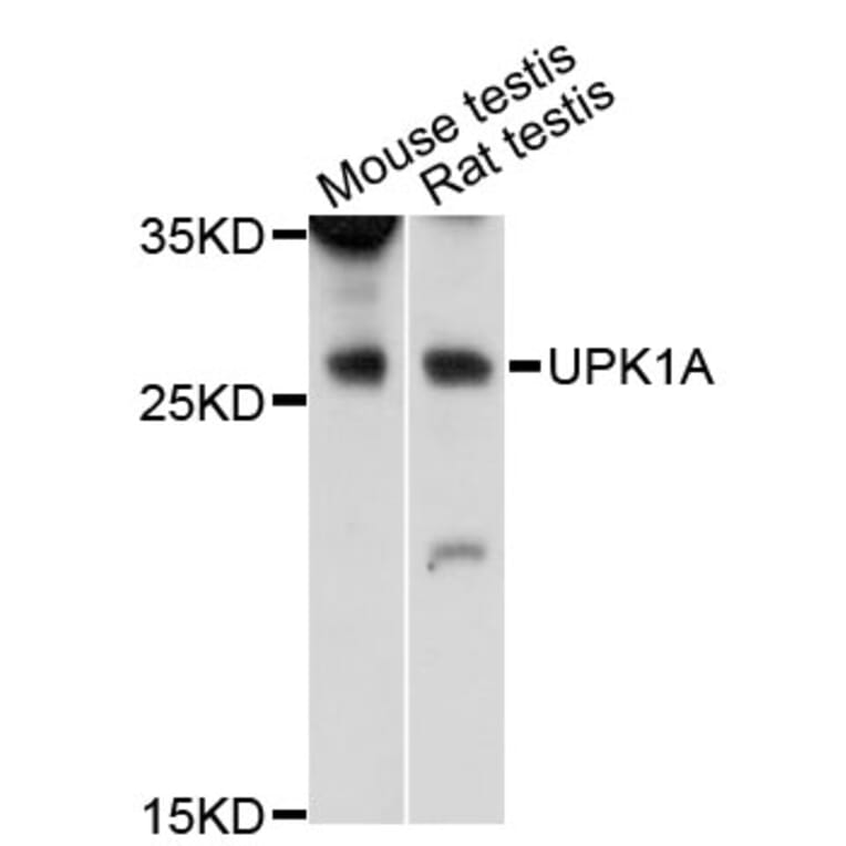 Western Blot - Anti-UPK1A Antibody (A12761) - Antibodies.com