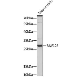 Western Blot - Anti-RNF125 Antibody (A89102) - Antibodies.com