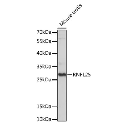 Western Blot - Anti-RNF125 Antibody (A89102) - Antibodies.com