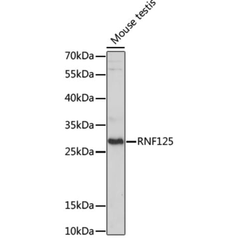 Western Blot - Anti-RNF125 Antibody (A89102) - Antibodies.com