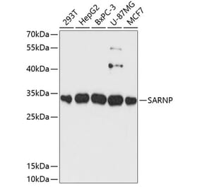 Western Blot - Anti-CIP29 Antibody (A89103) - Antibodies.com
