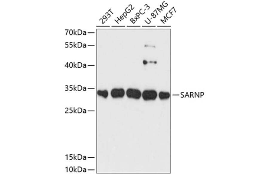Western Blot - Anti-CIP29 Antibody (A89103) - Antibodies.com
