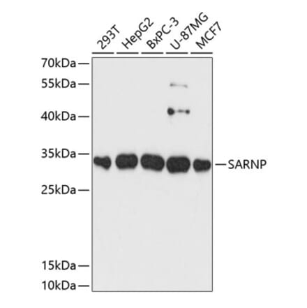 Western Blot - Anti-CIP29 Antibody (A89103) - Antibodies.com