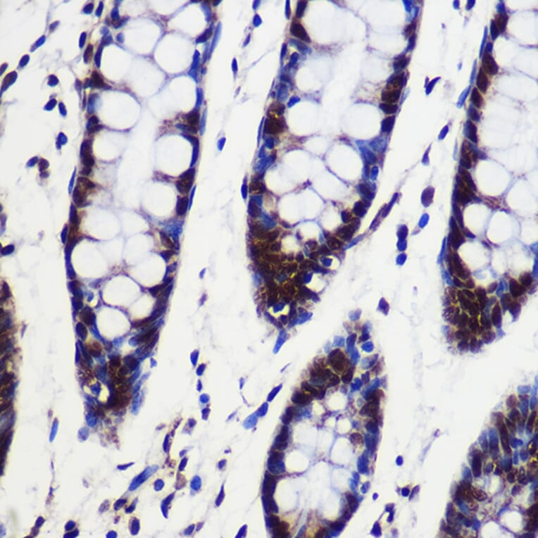 Immunohistochemistry - Anti-CIP29 Antibody (A89103) - Antibodies.com