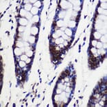 Immunohistochemistry - Anti-CIP29 Antibody (A89103) - Antibodies.com