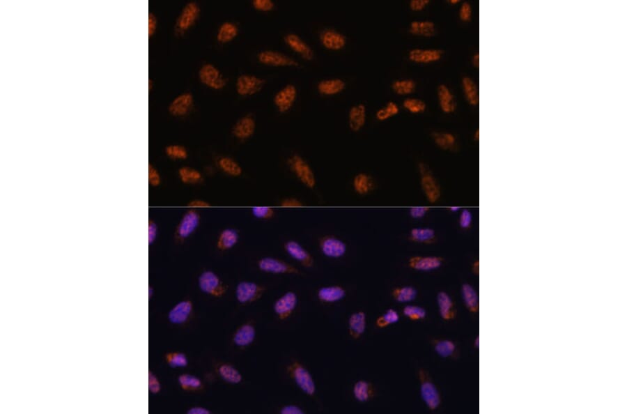 Immunofluorescence - Anti-CIP29 Antibody (A89103) - Antibodies.com