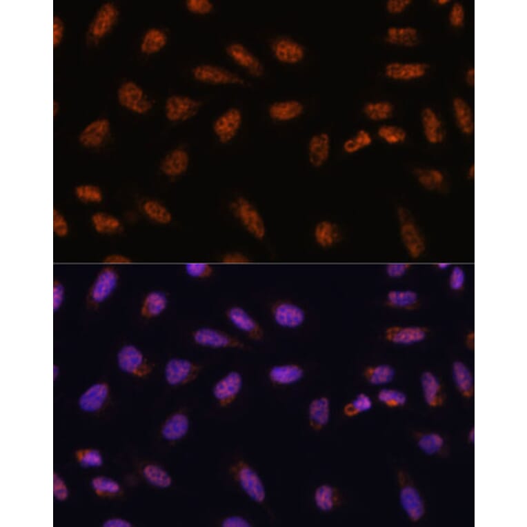 Immunofluorescence - Anti-CIP29 Antibody (A89103) - Antibodies.com