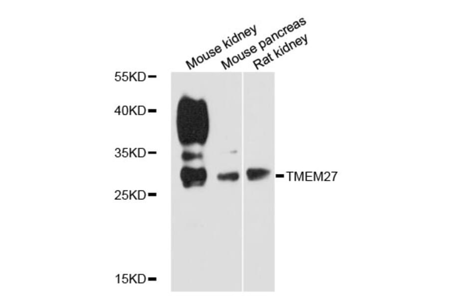 Western Blot - Anti-TMEM27 Antibody (A12715) - Antibodies.com