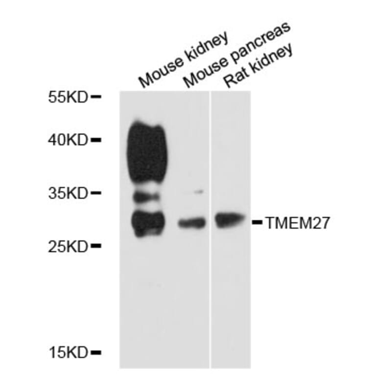 Western Blot - Anti-TMEM27 Antibody (A12715) - Antibodies.com