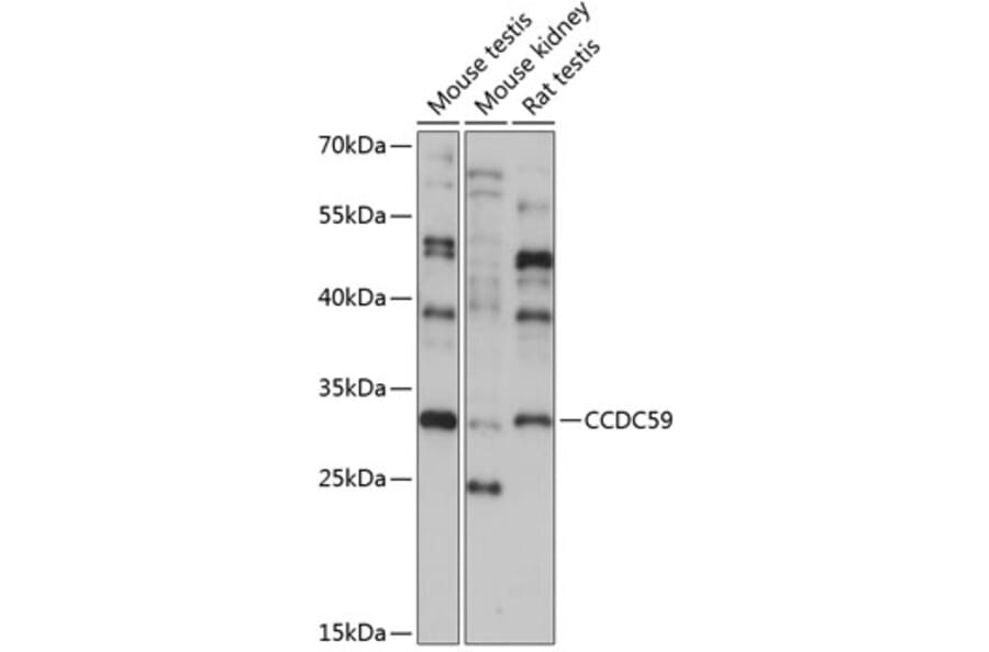 Western Blot - Anti-CCDC59 Antibody (A89105) - Antibodies.com