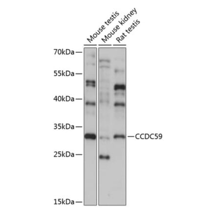 Western Blot - Anti-CCDC59 Antibody (A89105) - Antibodies.com