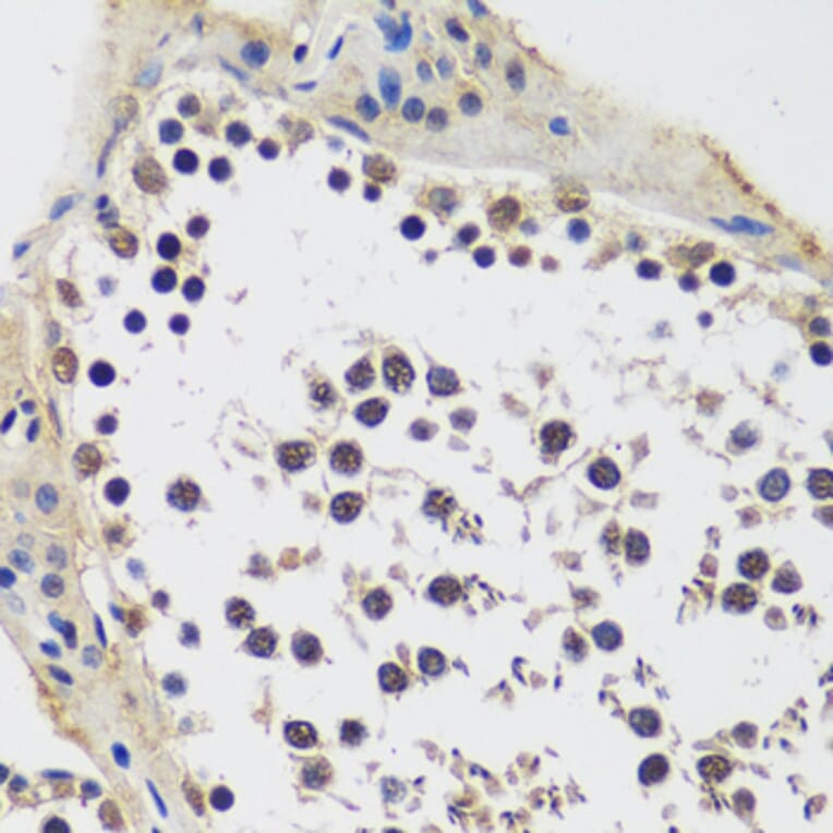 Immunohistochemistry - Anti-CCDC59 Antibody (A89105) - Antibodies.com