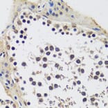 Immunohistochemistry - Anti-CCDC59 Antibody (A89105) - Antibodies.com