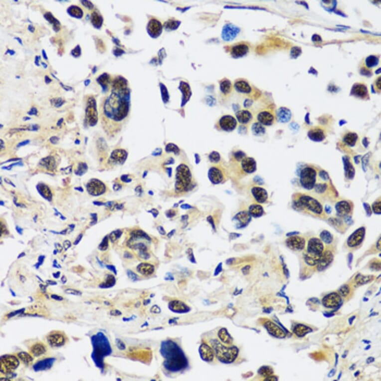 Immunohistochemistry - Anti-CCDC59 Antibody (A89105) - Antibodies.com