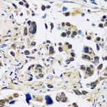 Immunohistochemistry - Anti-CCDC59 Antibody (A89105) - Antibodies.com