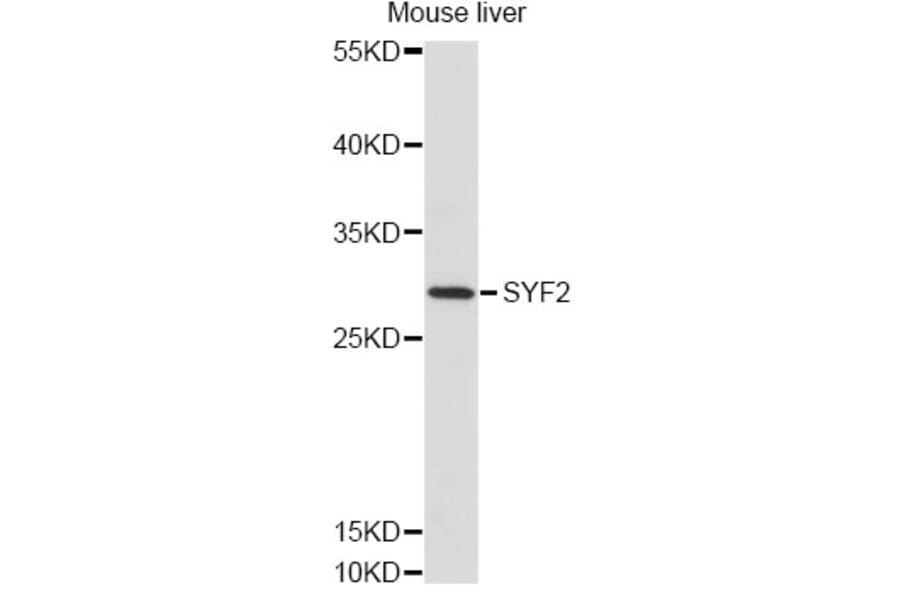 Western Blot - Anti-SYF2 Antibody (A14396) - Antibodies.com