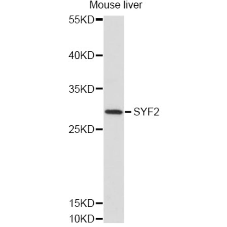 Western Blot - Anti-SYF2 Antibody (A14396) - Antibodies.com