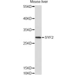 Western Blot - Anti-SYF2 Antibody (A14396) - Antibodies.com
