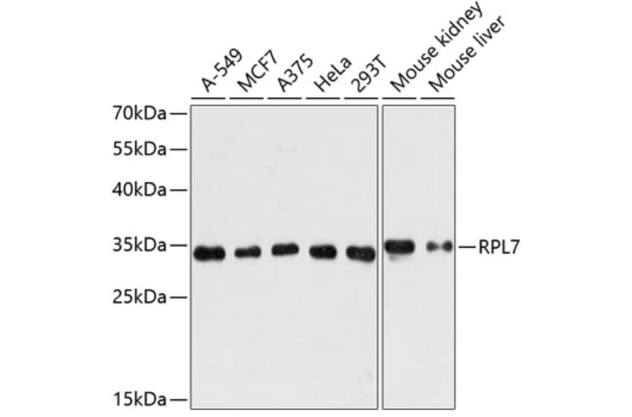 Western Blot - Anti-RPL7 Antibody (A89107) - Antibodies.com