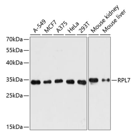 Western Blot - Anti-RPL7 Antibody (A89107) - Antibodies.com