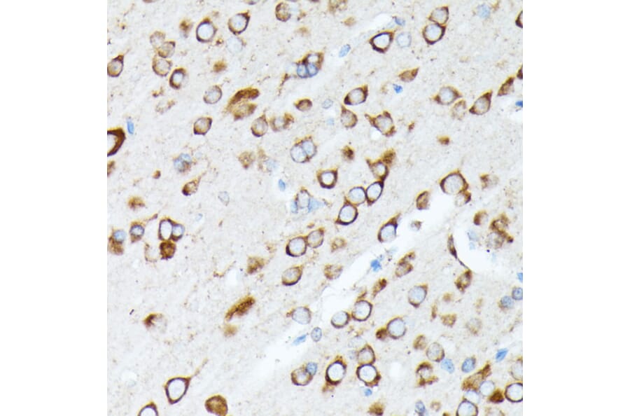 Immunohistochemistry - Anti-RPL7 Antibody (A89107) - Antibodies.com