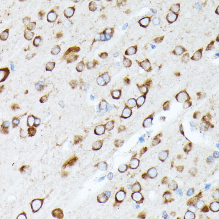 Immunohistochemistry - Anti-RPL7 Antibody (A89107) - Antibodies.com