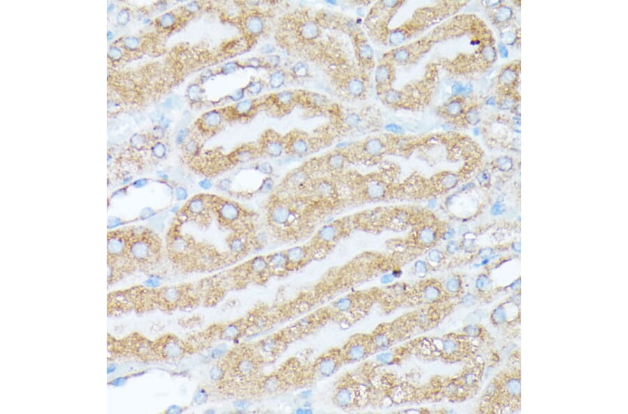 Immunohistochemistry - Anti-RPL7 Antibody (A89107) - Antibodies.com