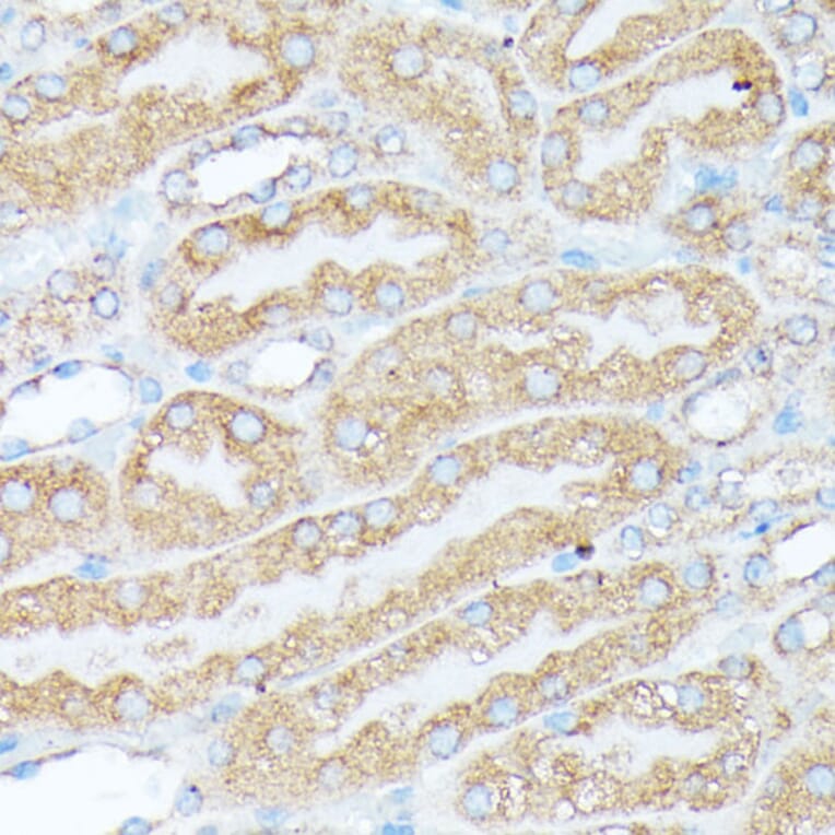 Immunohistochemistry - Anti-RPL7 Antibody (A89107) - Antibodies.com