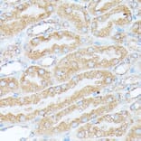 Immunohistochemistry - Anti-RPL7 Antibody (A89107) - Antibodies.com