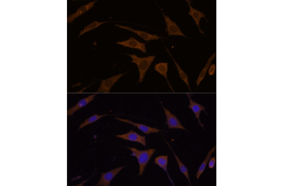 Immunofluorescence - Anti-RPL7 Antibody (A89107) - Antibodies.com