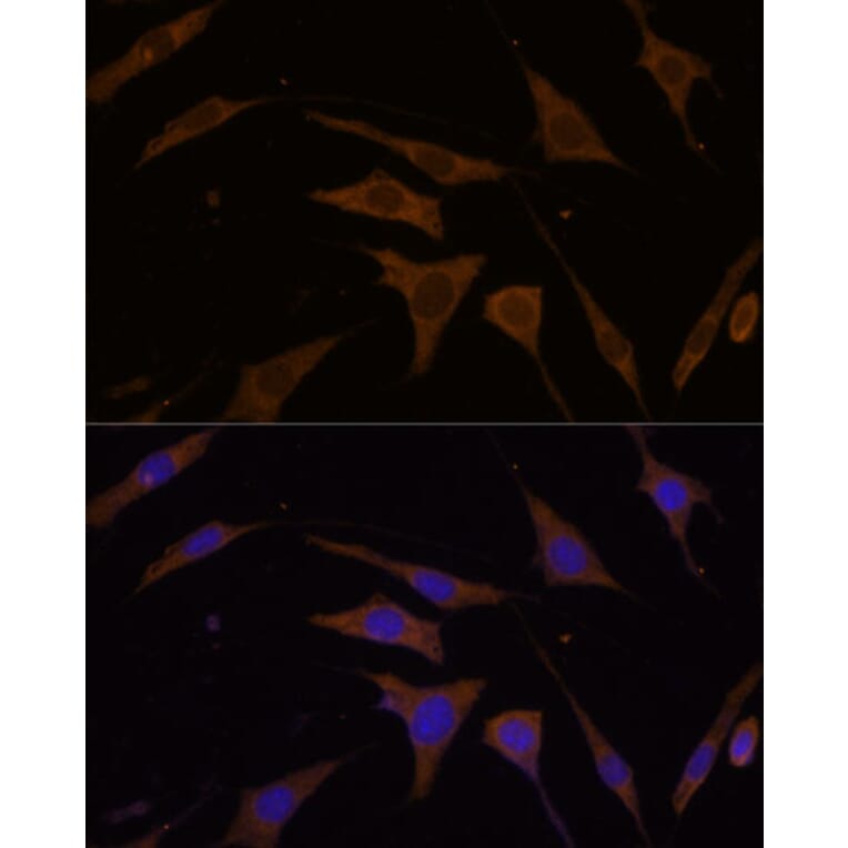Immunofluorescence - Anti-RPL7 Antibody (A89107) - Antibodies.com