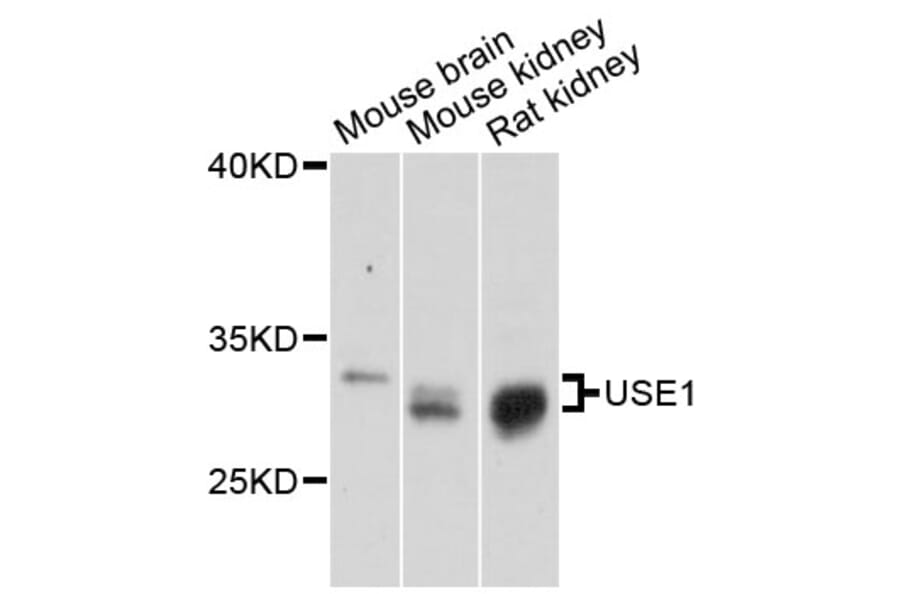 Western Blot - Anti-USE1 Antibody (A13147) - Antibodies.com