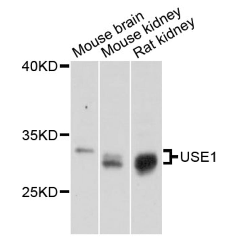 Western Blot - Anti-USE1 Antibody (A13147) - Antibodies.com