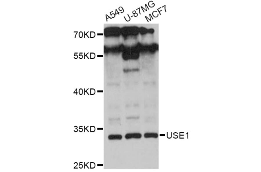 Western Blot - Anti-USE1 Antibody (A13151) - Antibodies.com