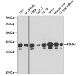 Western Blot - Anti-PSMA4 Antibody (A89110) - Antibodies.com