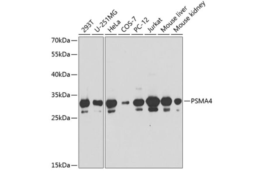 Western Blot - Anti-PSMA4 Antibody (A89110) - Antibodies.com