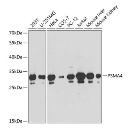 Western Blot - Anti-PSMA4 Antibody (A89110) - Antibodies.com