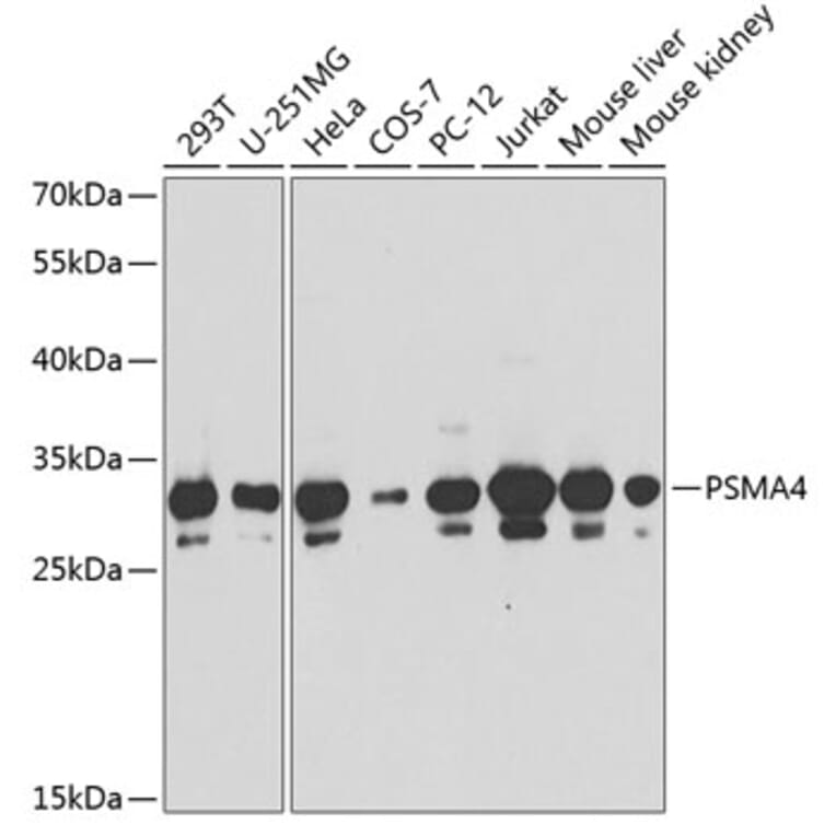Western Blot - Anti-PSMA4 Antibody (A89110) - Antibodies.com