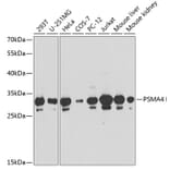 Western Blot - Anti-PSMA4 Antibody (A89110) - Antibodies.com
