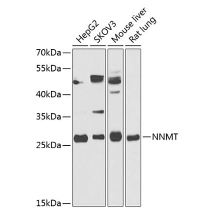 Western Blot - Anti-NNMT Antibody (A89111) - Antibodies.com