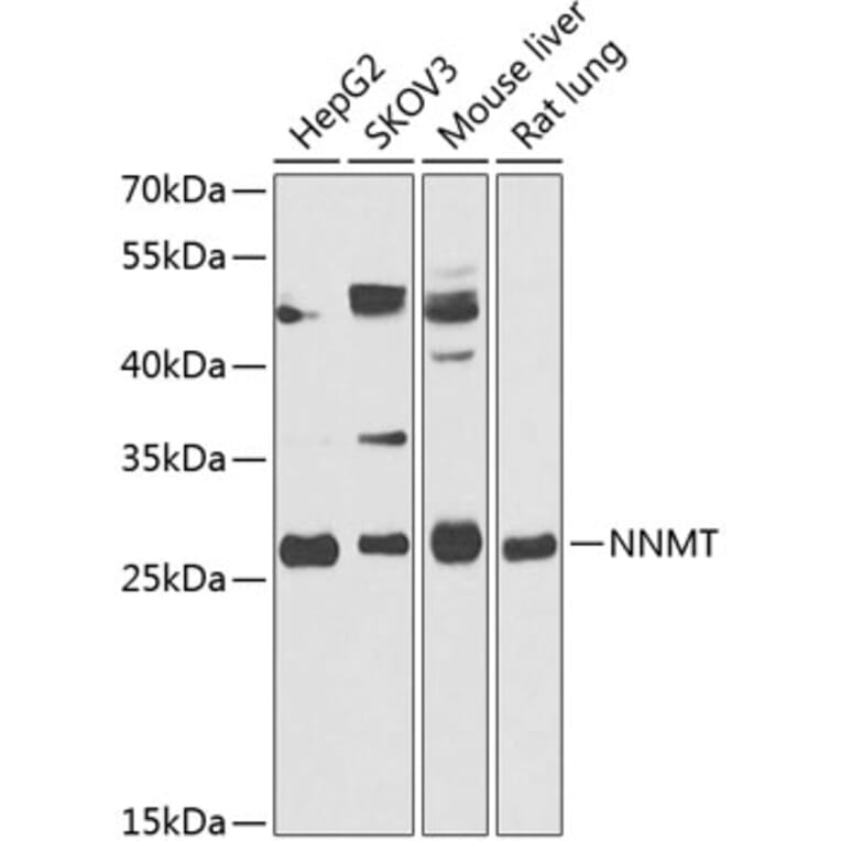 Western Blot - Anti-NNMT Antibody (A89111) - Antibodies.com