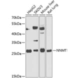 Western Blot - Anti-NNMT Antibody (A89111) - Antibodies.com