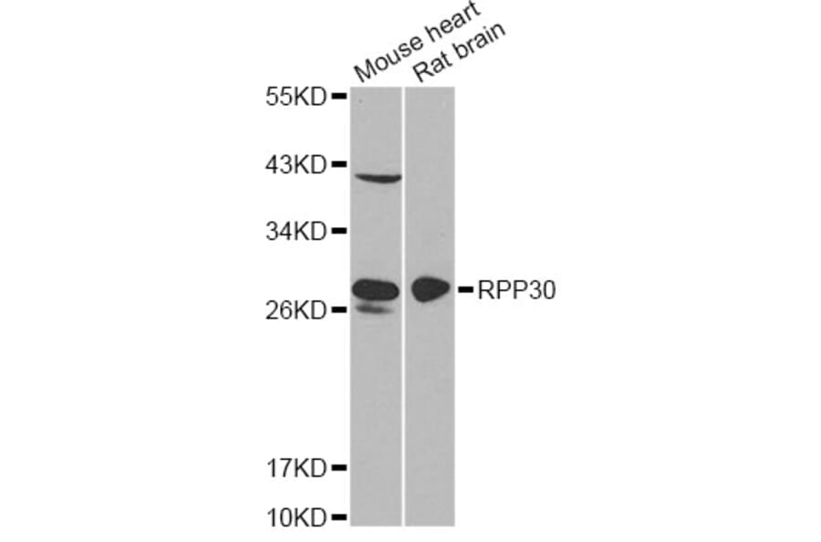 Western Blot - Anti-RPP30 Antibody (A12560) - Antibodies.com