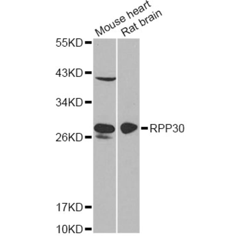 Western Blot - Anti-RPP30 Antibody (A12560) - Antibodies.com