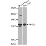 Western Blot - Anti-RPP30 Antibody (A12560) - Antibodies.com