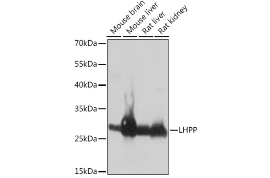 Western Blot - Anti-LHPP Antibody (A89113) - Antibodies.com
