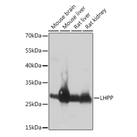 Western Blot - Anti-LHPP Antibody (A89113) - Antibodies.com