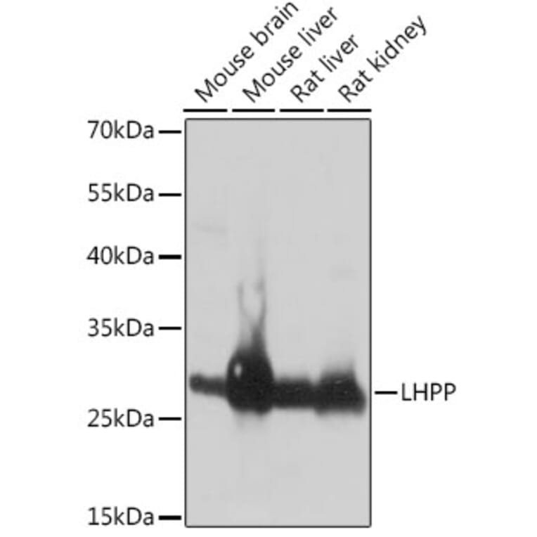 Western Blot - Anti-LHPP Antibody (A89113) - Antibodies.com
